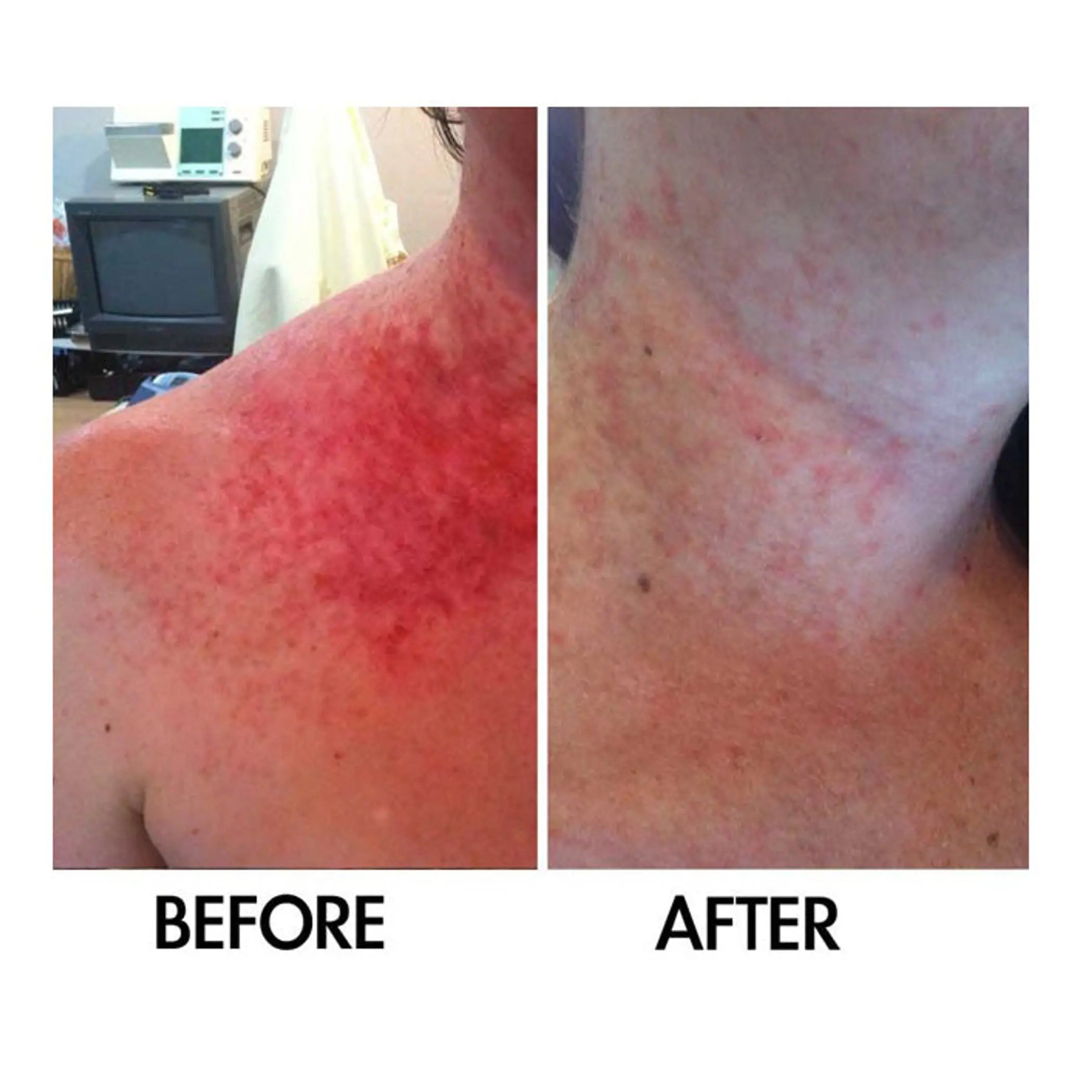 Derm #1 Dry Skin Rescue with Vitamin B3 3.38 oz DermOne Health & Wellness