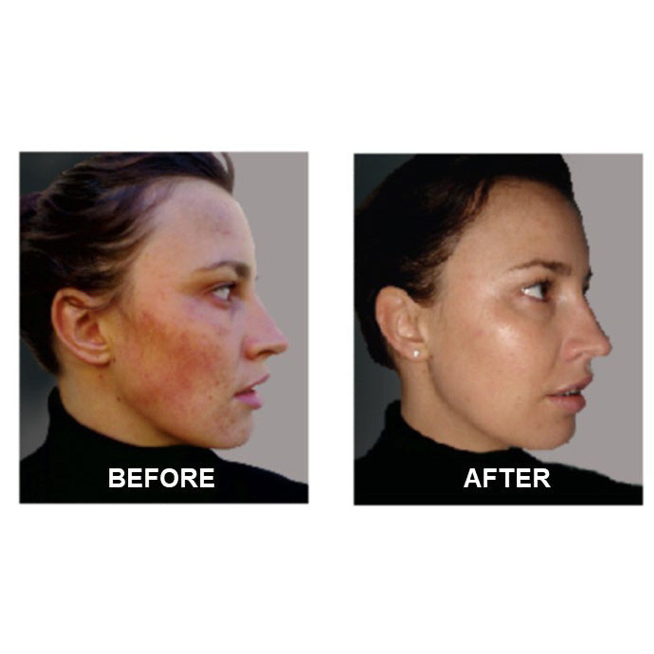 Derm #1 Two Step Regimen DermOne Health & Wellness
