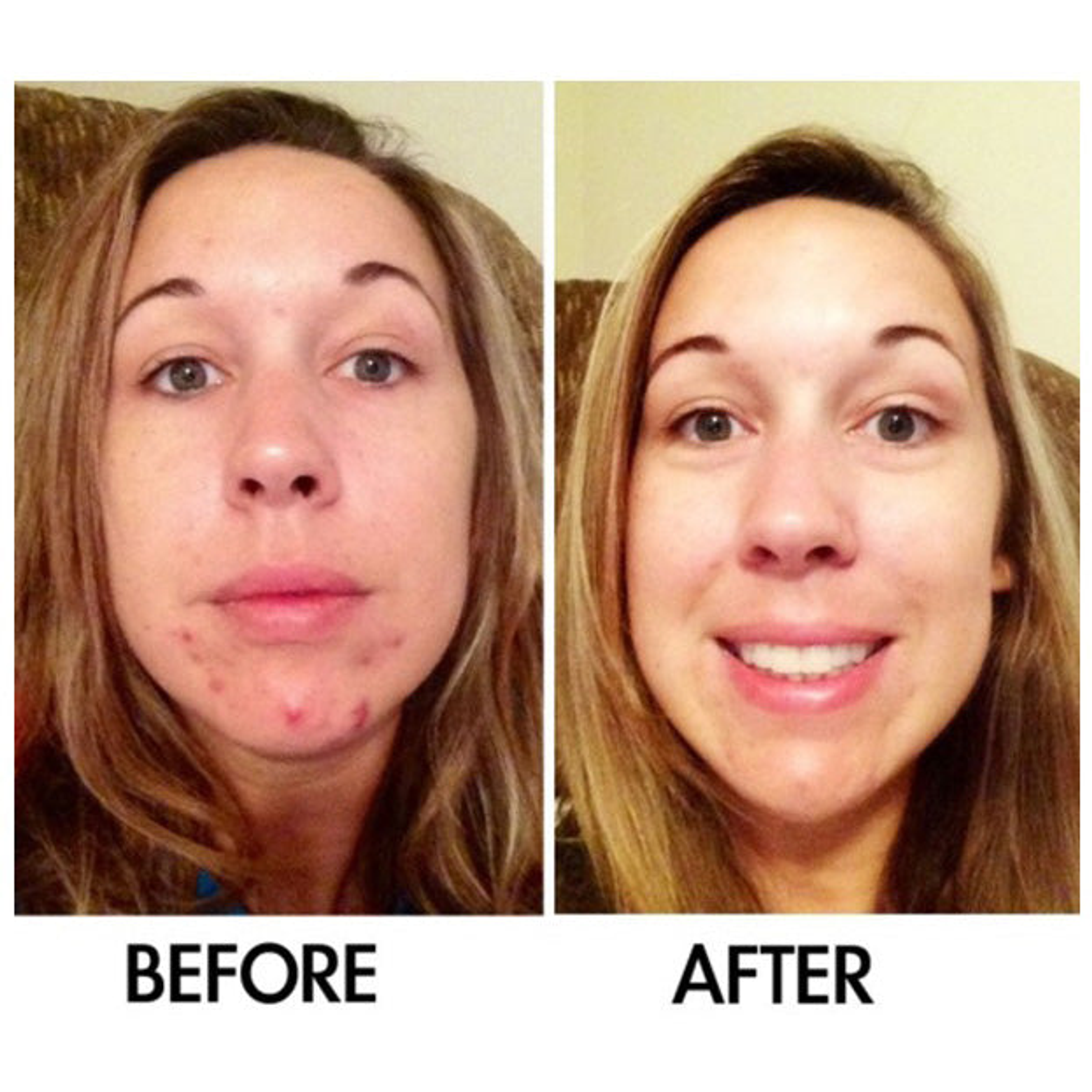 Derm #1 Two Step Regimen DermOne Health & Wellness