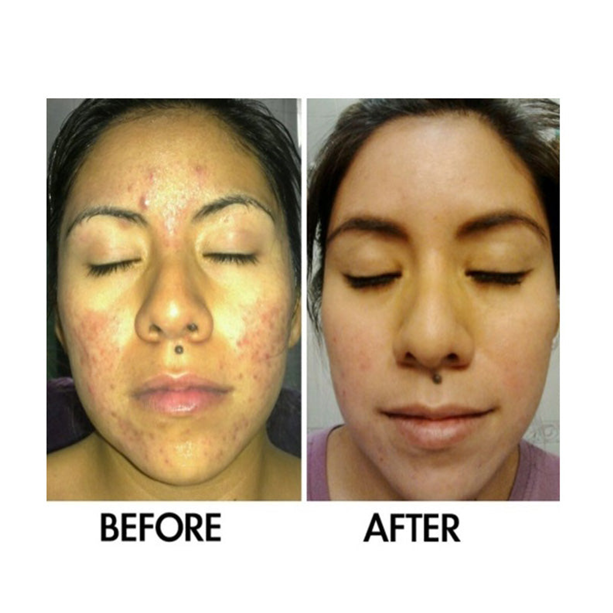 Derm #1 Two Step Regimen DermOne Health & Wellness