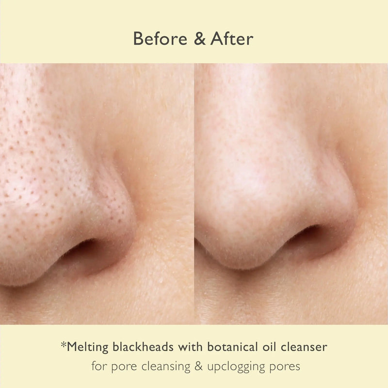 No Pore Cleansing Oil | Makeup Cleansing Oil | Pore Cleansing Blackheads Removal | Olive Oil Tea Tree Squalane | Korean Skin Care for face (6.76 fl.oz) Nowater