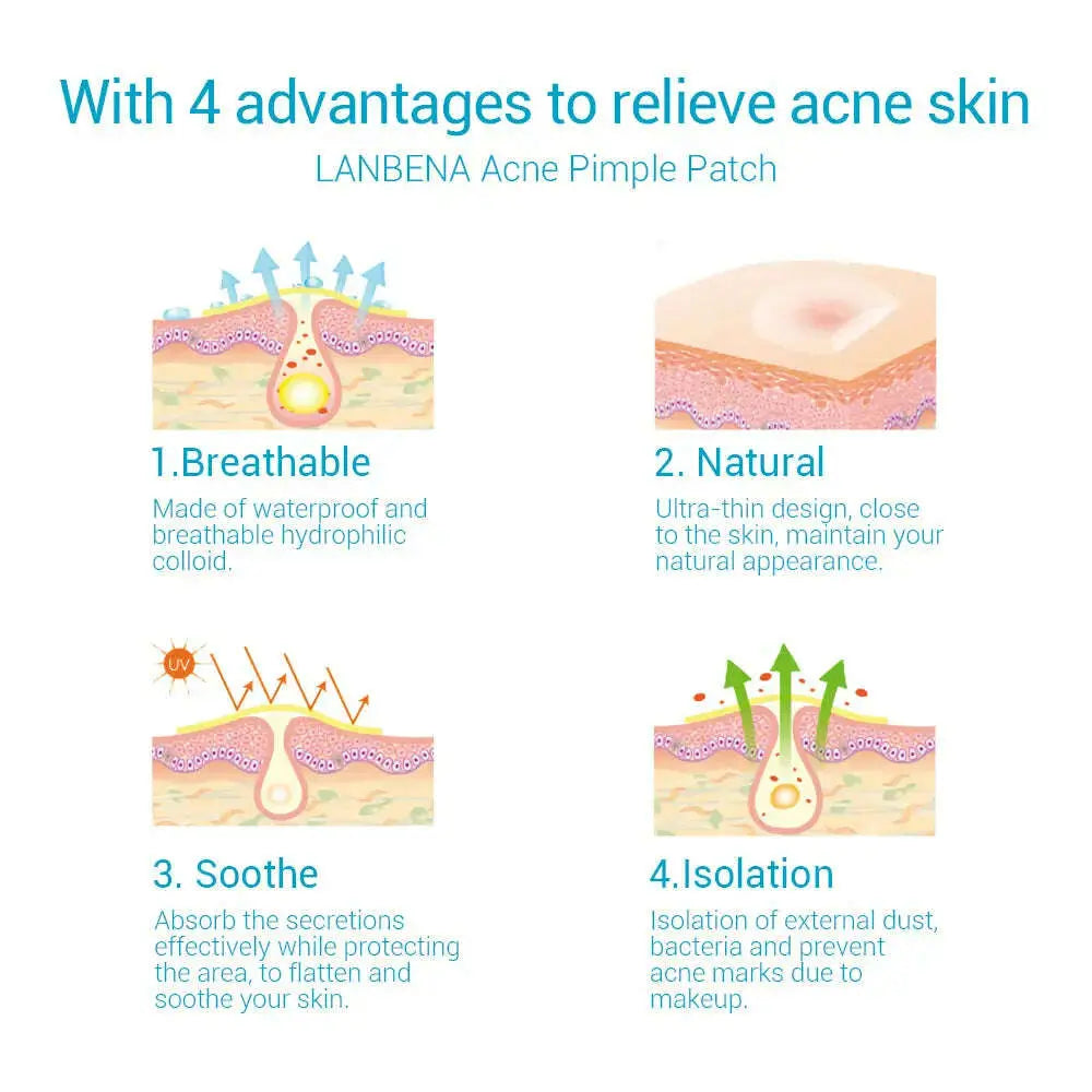 Acne-Pimple-Patch-Invisible-Acne-Stickers-Blemish-Treatment-Acne-Master-Pimple-Remover-Beauty-Tool-Skin-Care-GreatEagleInc-334013892