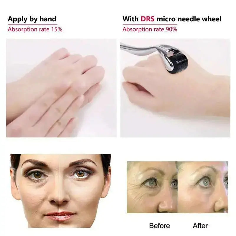 DARSONVAL-DRS-540-derma-roller-micro-needles-titanium-mezoroller-microneedle-machine-for-skin-care-and-body-treatment-GreatEagleInc-318360349